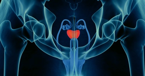 มะเร็งต่อมลูกหมาก (Prostate cancer) : อาการ สาเหตุ การรักษา