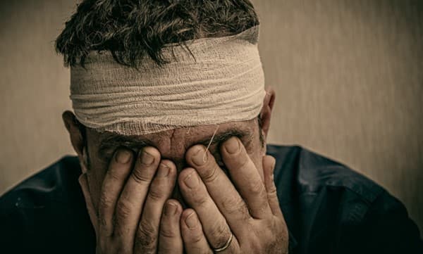 บาดเจ็บที่ศีรษะ (Head Injury) : อาการ สาเหตุ การรักษา