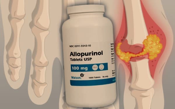 อัลโลพูลินอล (Allopurinol) : วิธีใช้ และข้อควรระวัง
