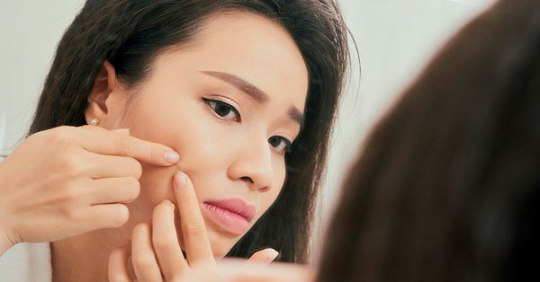 วิธีกดสิวอย่างปลอดภัย (How to Pop a Pimple)