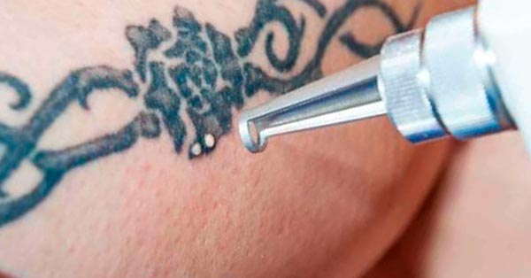 Do Tattoos Hurt