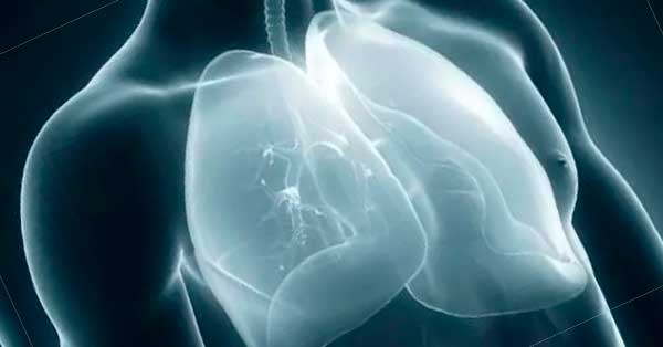 What Need to Know About Pleurisy