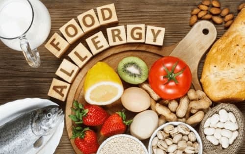 How to Deal With Food Allergies