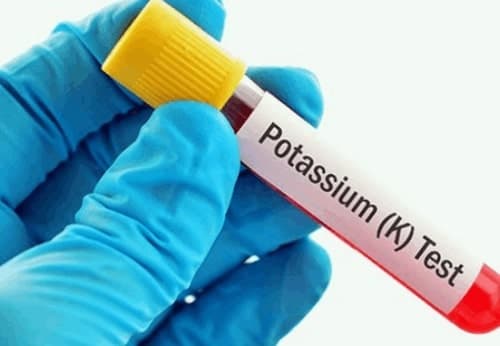 Hypokalemia-Low Potassium in Blood