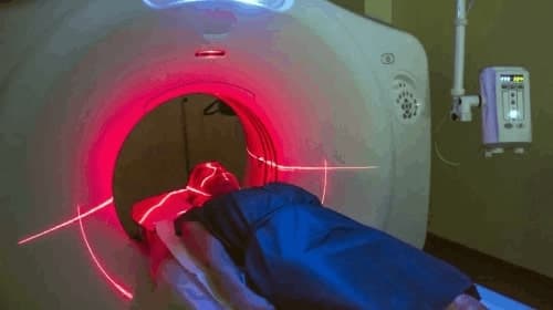 พีอีที สแกน (PET Scan)