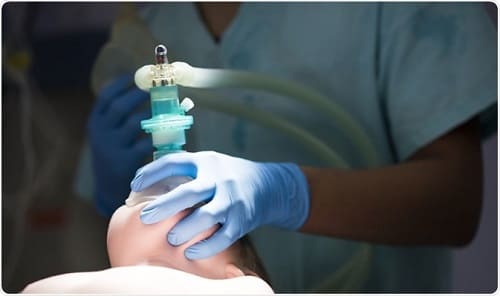 General Anesthesia
