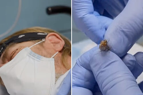 insects in ear