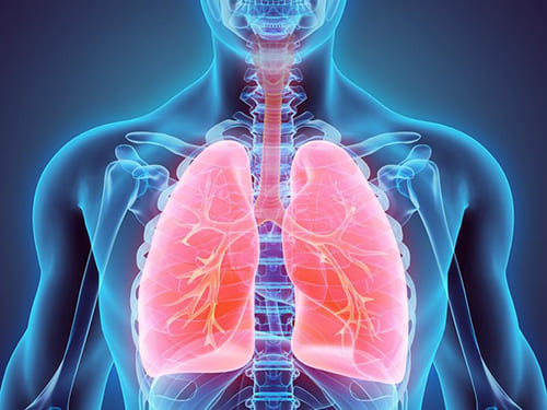 โรคระบบทางเดินหายใจเฉียบพลัน (ARDS-Acute respiratory distress syndrome)