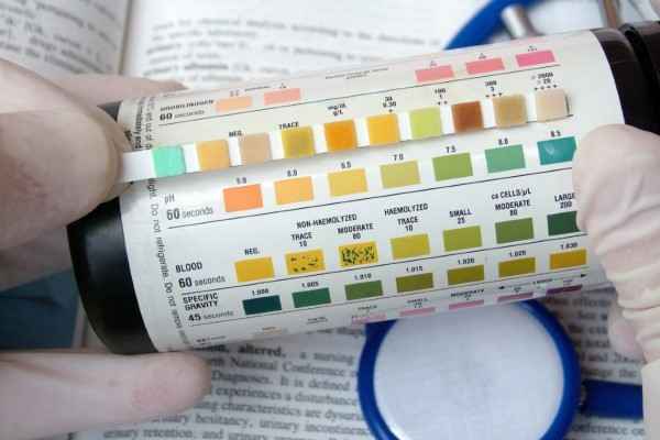 Urinalysis