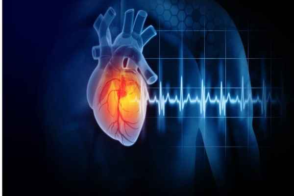What is Angina?